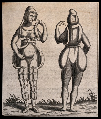 V0009580 An hermaphrodite, front and back view, wearing a loose costu